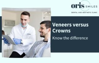 Dental Veneers Vs Dental Crowns| Know the difference