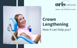 How can Crown Lengthening help you? - Crown Lengthening Treatment Ahmedabad