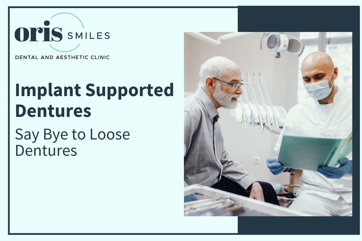 Say Bye to Loose Dentures - Implant-Supported Dentures Ahmedabad