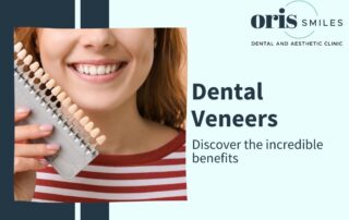 Dental Veneers Benefits