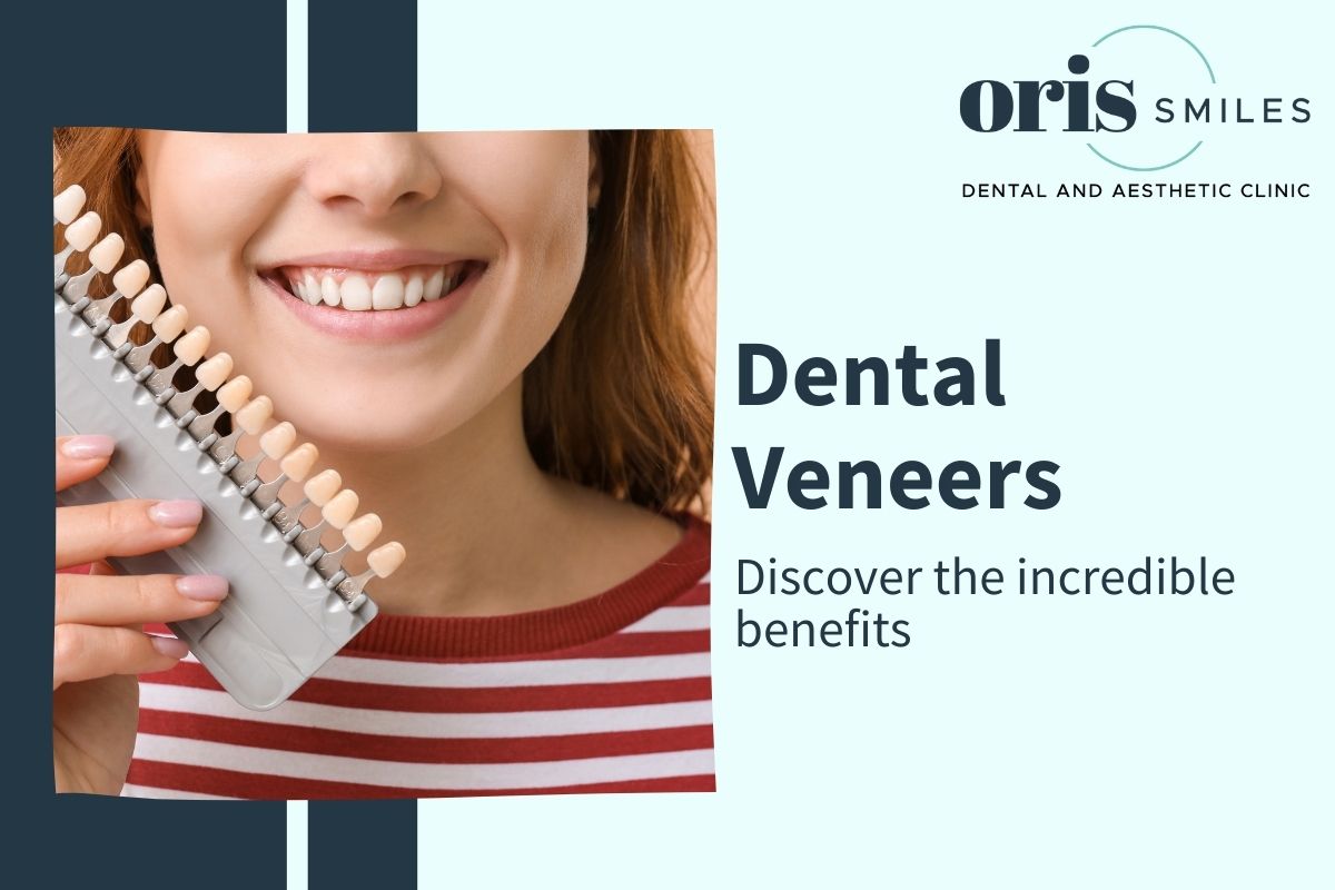 Dental Veneers Benefits