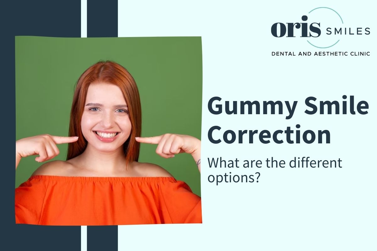 Gummy Smile Correction Ahmedabad