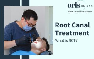 What is RCT treatment? - Root canal treatment explained