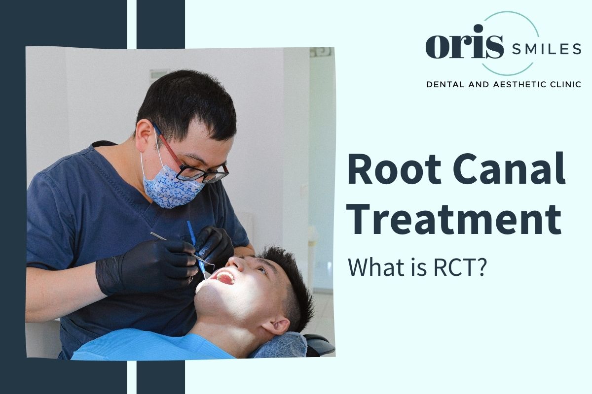 What is RCT treatment? - Root canal treatment explained