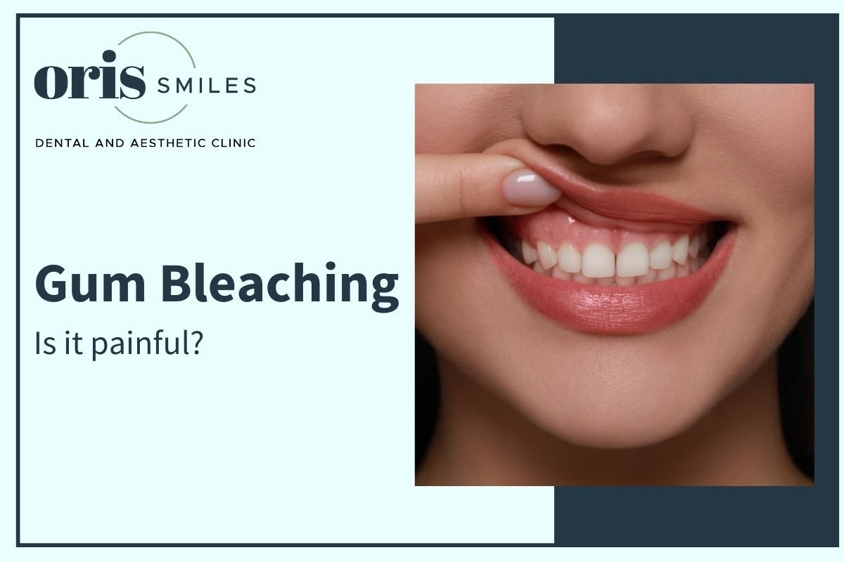 is-gum-bleaching-painful-blog-oris
