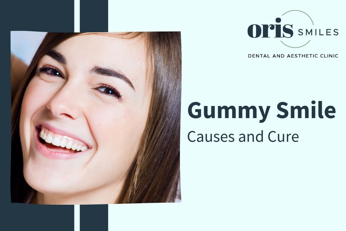 are-gummy-smiles-unattractive-oris