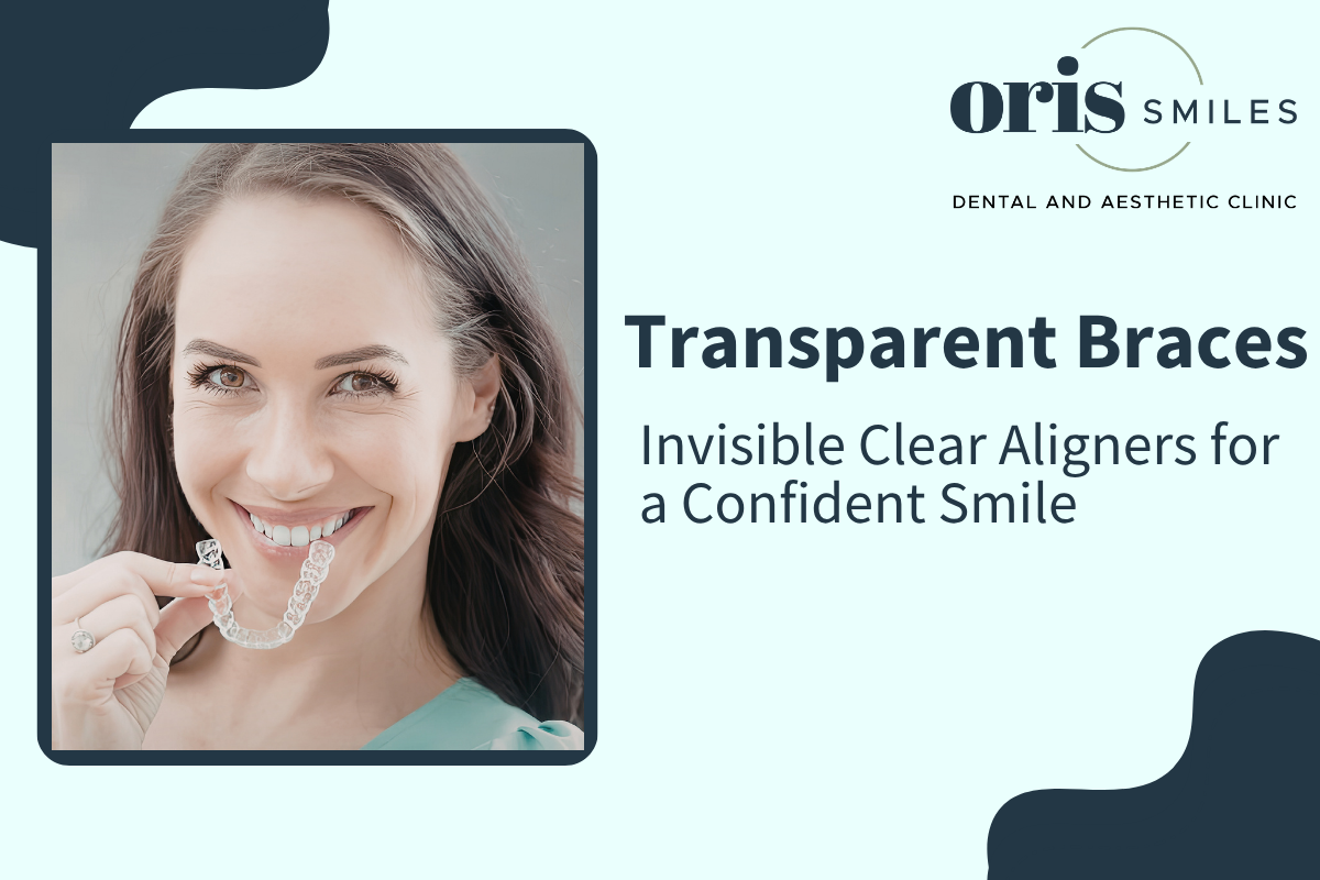 Transparent Braces-Oris Smiles – Featured Images