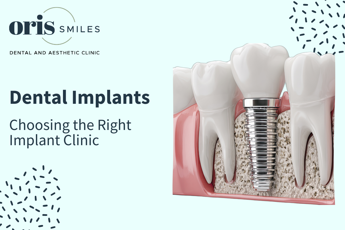 Choosing implant clinic April- 32 Oris Smiles – Featured Images