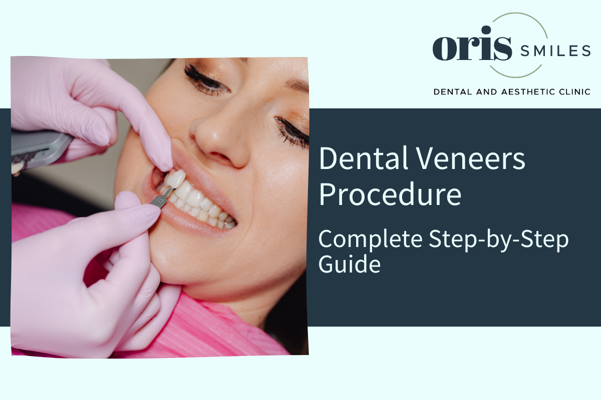 Dental Veneers Procedure
