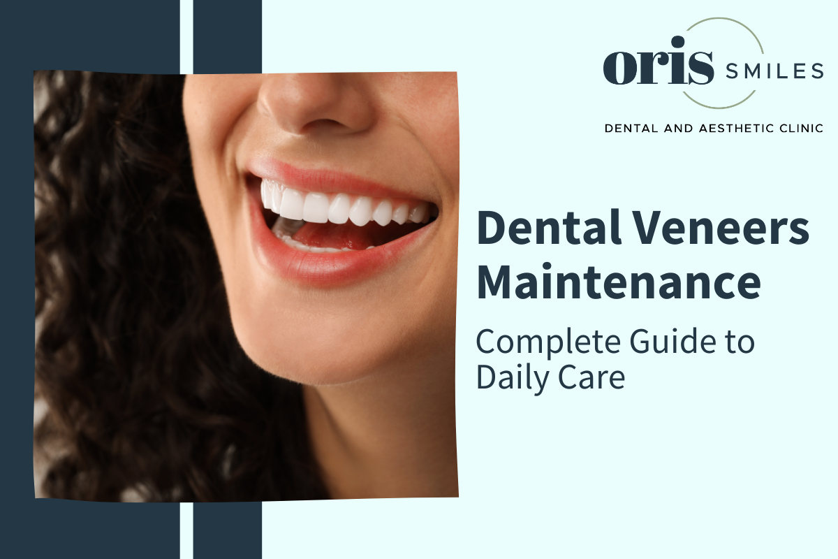 Dental Veneers Maintenancetreatment