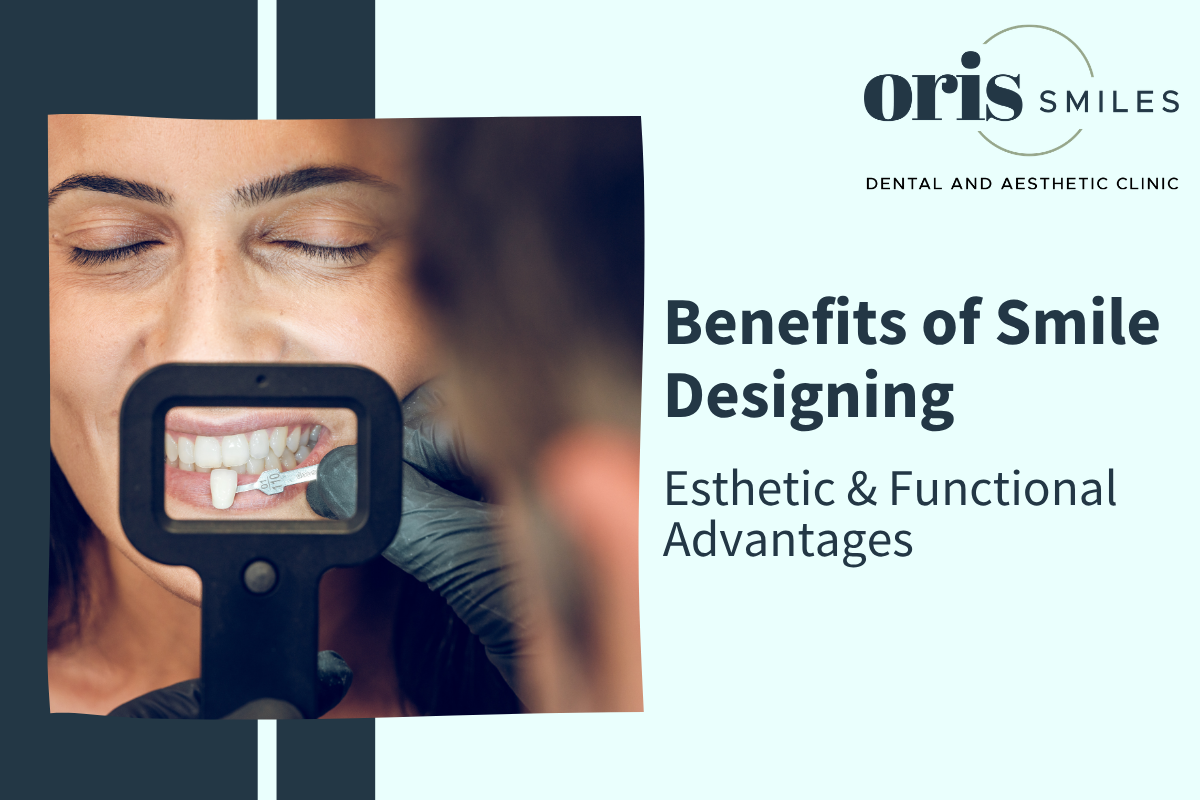 Benefits of Smile Designing