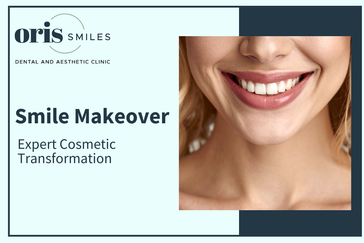 Smile Makeover