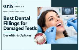 best dental fillings