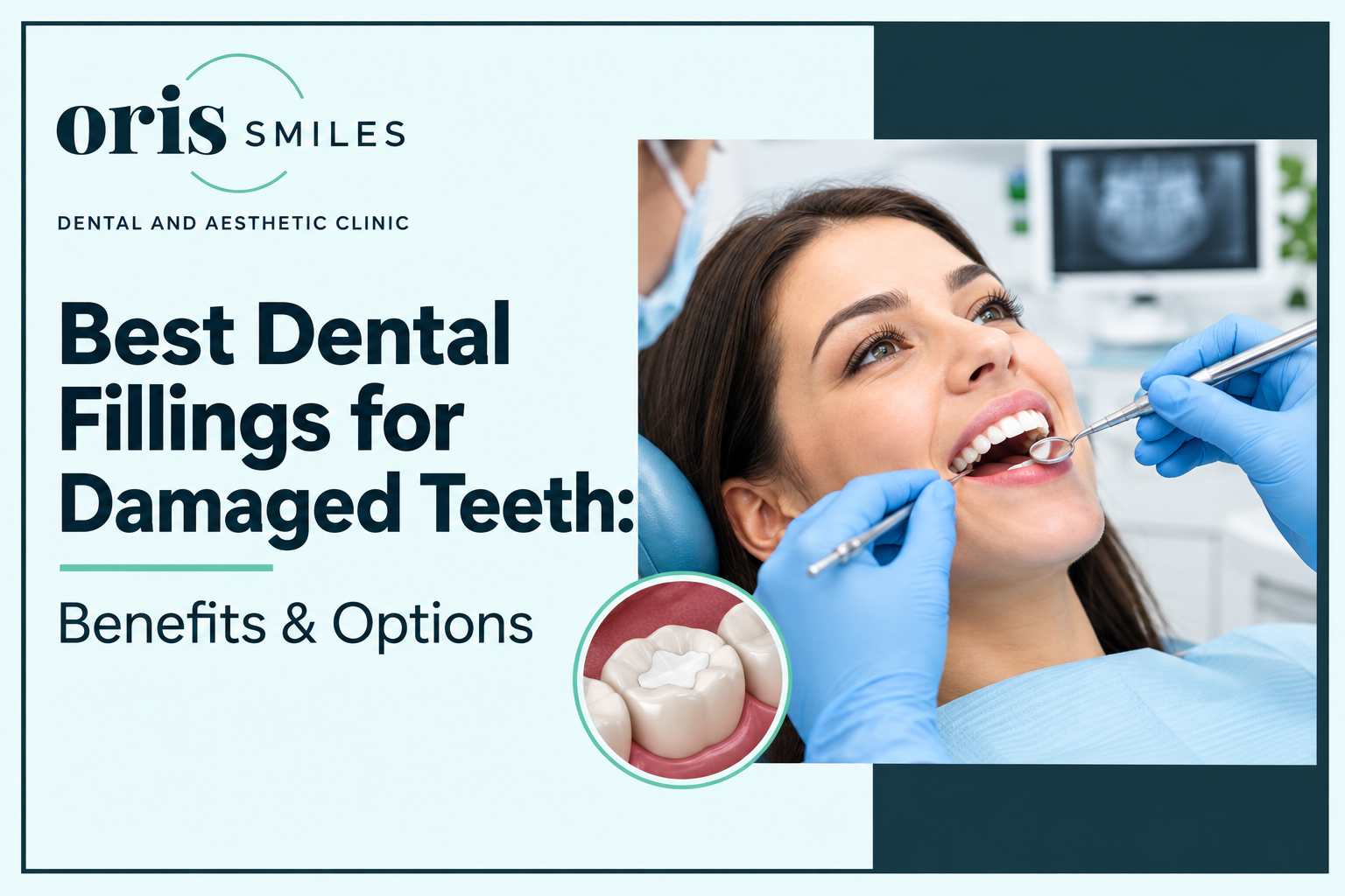 Best Dental Fillings for Damaged Teeth Benefits & Options best dental fillings