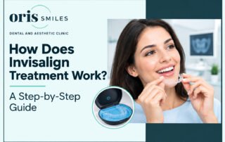 invisalign aligners
